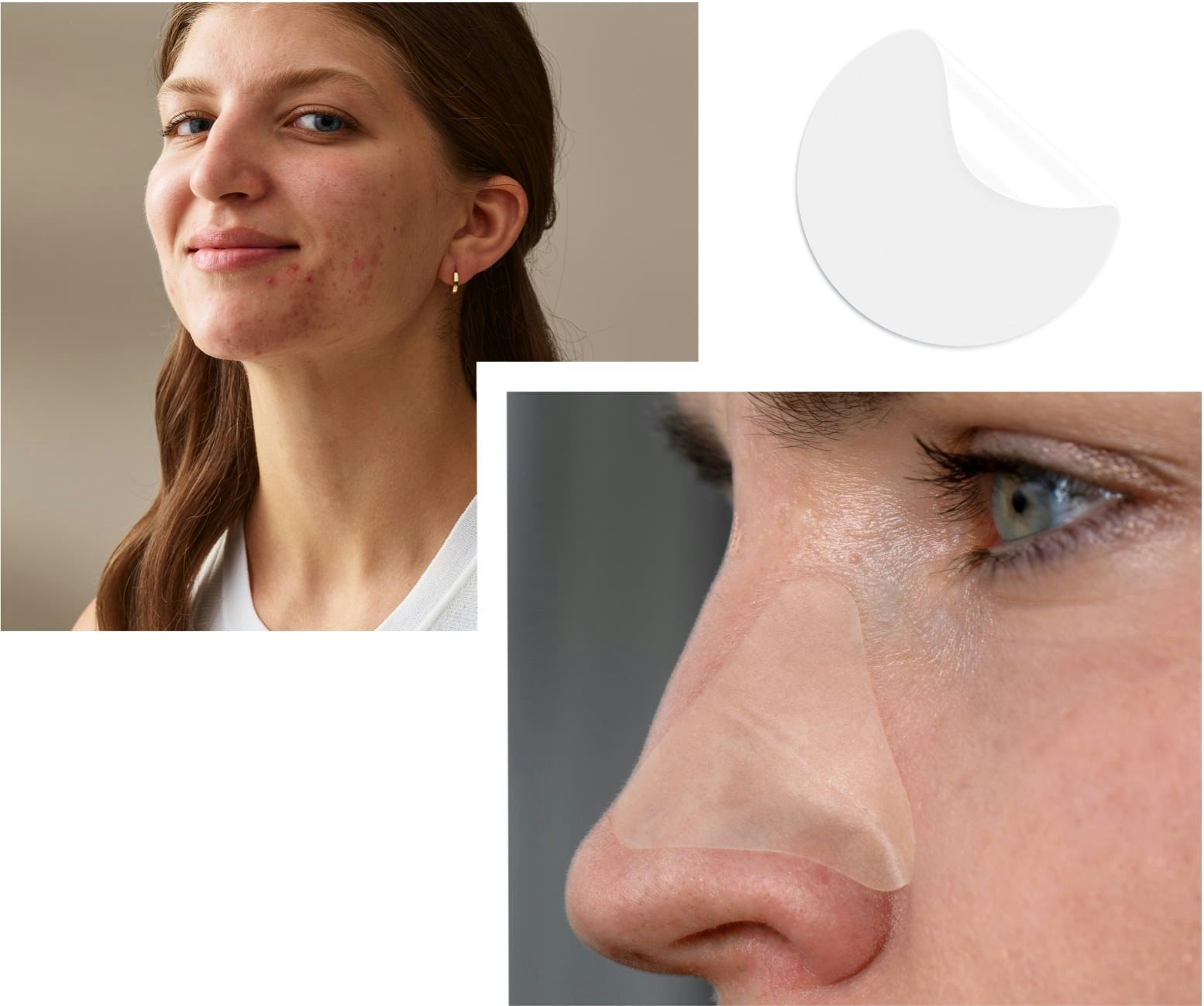 Neutrogena Stubborn Acne<sup>®</sup> Ultra-Thin Blemish Patches, 24 Patches
